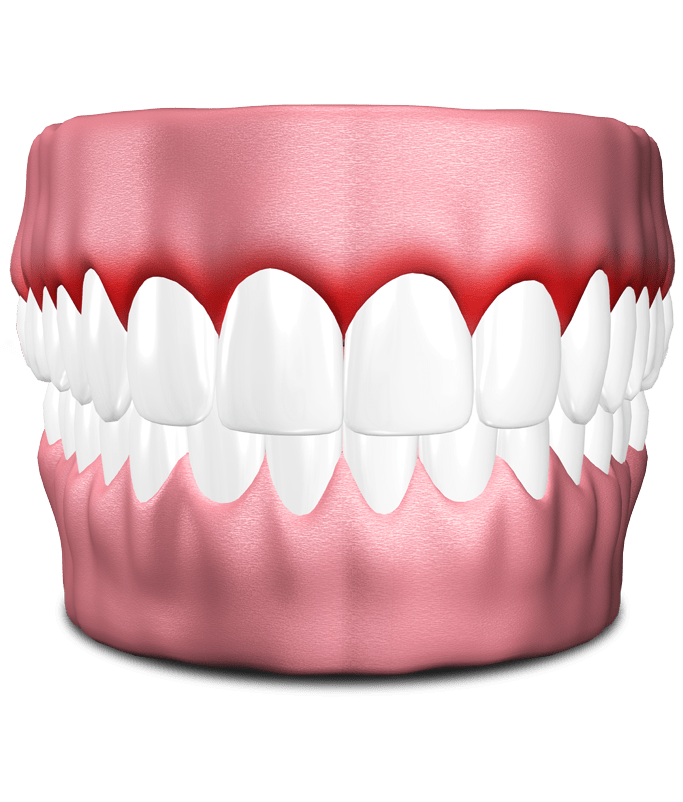 teeth with gum disease model Annandale, VA